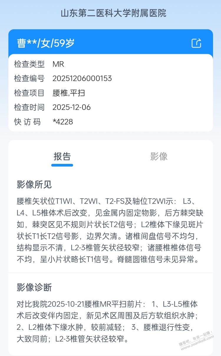 唉,母亲要第三次腰间盘突出手术了,愁死人了,有基础病能不做 ..